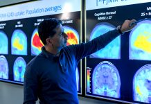 AbbVie celuje w chorobę Alzheimera